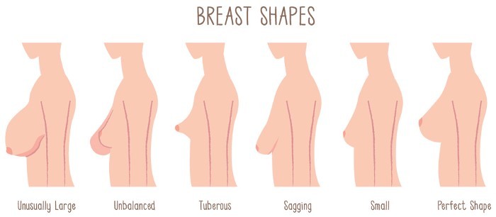breast-shapes